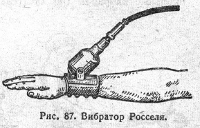 Вибратор Росселя